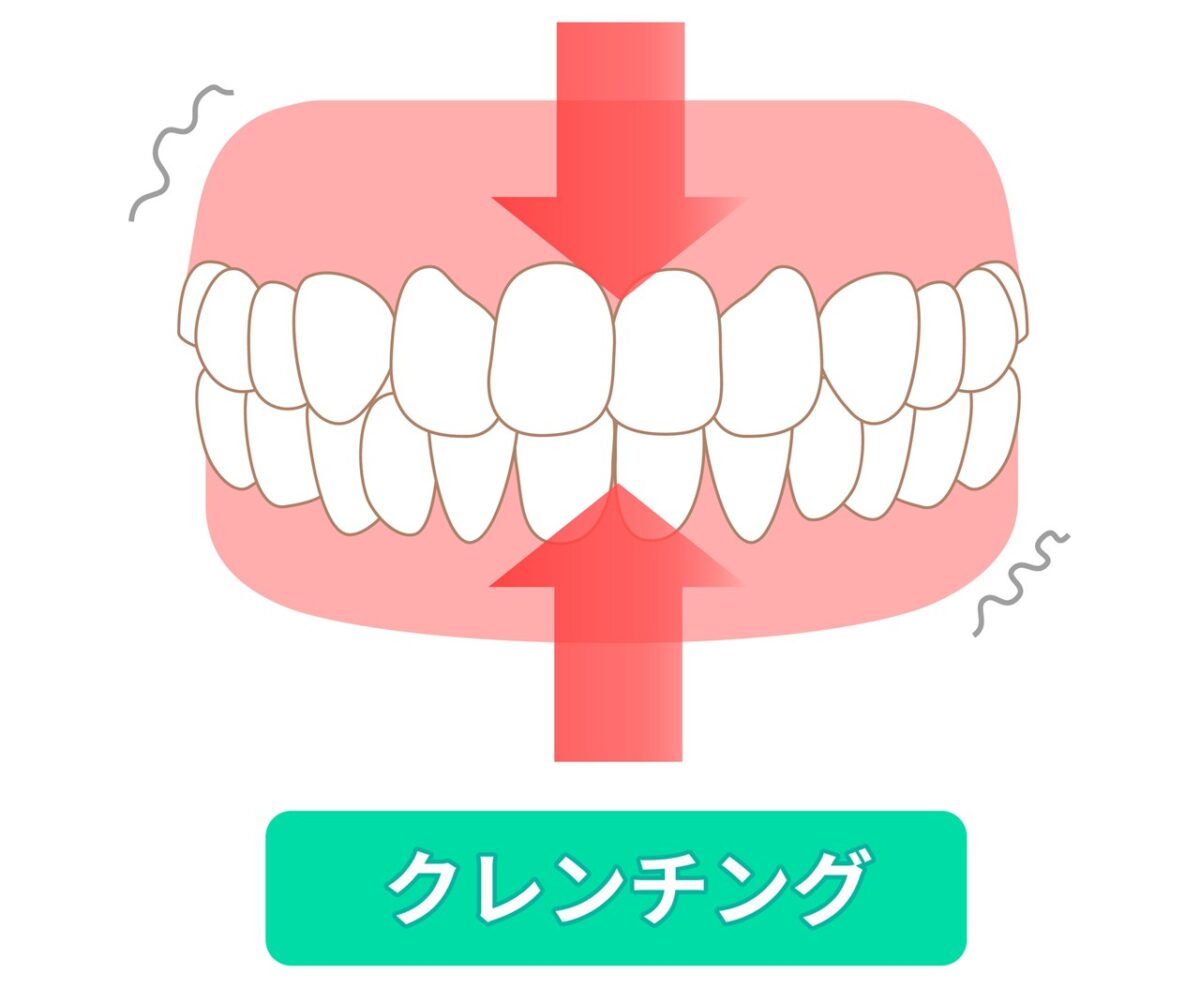 クレンチング